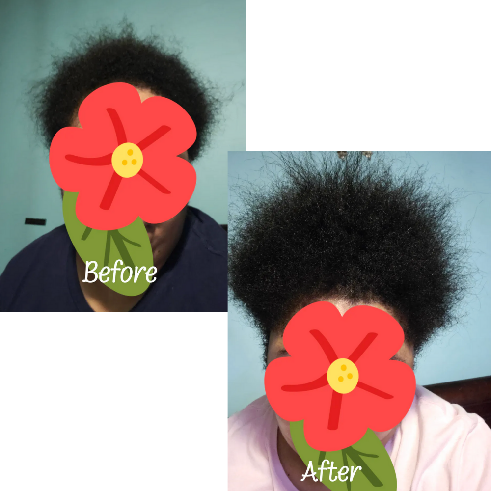 3 Month Hair Goals Growth Gummies